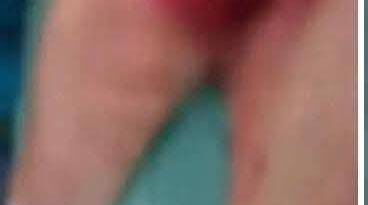 UNA MUJER LE CORTÓ EL PENE A SU PAREJA EN UN ATAQUE DE CELOS EN LOURDES COLÓN.