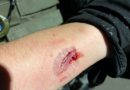 DEPARTAMENTO DE JUSTICIA DE EE.UU PRESENTÓ CARGOS CONTRA MANIFESTANTE ACUSADO DE AGREDIR A AGENTES DE ICE EN NUEVA JERSEY
