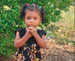 NIÑA DE 2 AÑOS PERMANECE EN ESTADO CRÍTICO TRAS SUFRIR MORDEDURA DE SERPIENTE EN HONDURAS