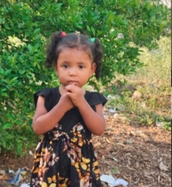 NIÑA DE 2 AÑOS PERMANECE EN ESTADO CRÍTICO TRAS SUFRIR MORDEDURA DE SERPIENTE EN HONDURAS