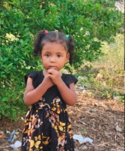NIÑA DE 2 AÑOS PERMANECE EN ESTADO CRÍTICO TRAS SUFRIR MORDEDURA DE SERPIENTE EN HONDURAS